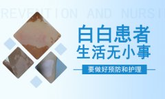 白癜风治疗北京医院浅谈白癜风怎样正确的保健