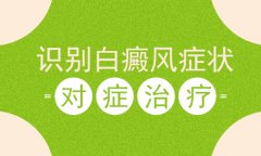 专家讲解哪些方法可帮助患者识别白癜风呢？