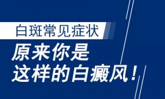 医院讲解：白癜风的白斑都有哪些症状特点?