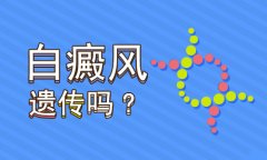 白癜风治疗的北京医院解答白癜风遗传吗?