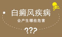 男性白癜风的危害有哪些？白癜风专科医院